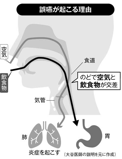 誤嚥が起こる理由　（週刊朝日　２０１７年１２月１日号より）