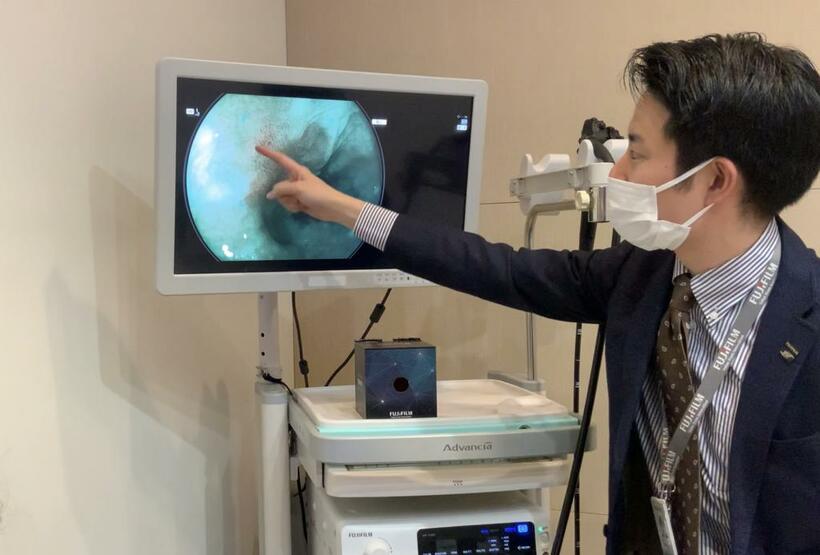 富士フイルム
浅野峻吾さん（３１）
１９９１年生まれ。２０１４年に同社に入社後、内視鏡機器の国内営業を担当。現在はメディカルシステム事業部内視鏡システム部で、主にＡＩ技術を活用した内視鏡診断支援システムの商品企画に従事（ｐｈｏｔｏ　古川雅子）