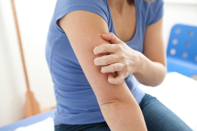 人間の免疫システムが“自然”のままに働けば、皮膚の乾燥をきっかけにアレルギーを発症するリスクが高まる（写真：getty images）
