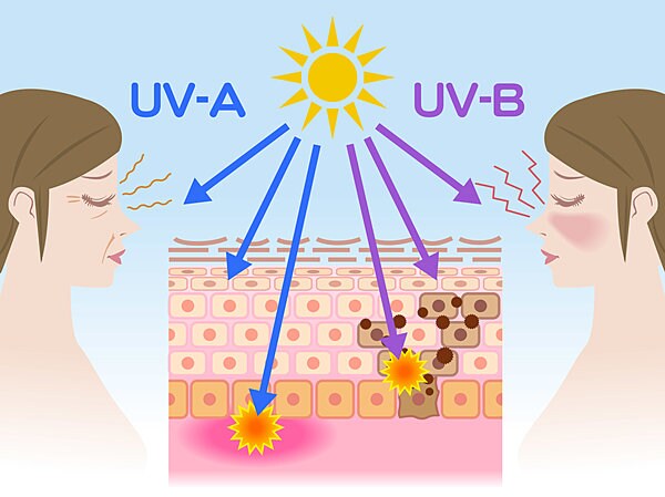 紫外線A波はシワや皮膚を硬くし、B波はシミの原因に