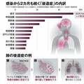 コロナ後遺症「再生早いはずなのに」 嗅覚障害・味覚障害のメカニズムのなぞ