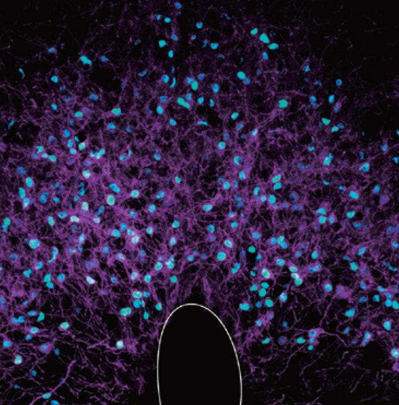 青く発色しているのが活性化した「Ｑ神経」。第三脳室前方の視床下部にあり、約９０％のＱ神経を活性化すると冬眠状態が誘導された（写真：筑波大学提供）