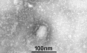 「風邪で抗生物質」が人類の危機を…薬剤耐性菌で年間8千人以上が死亡