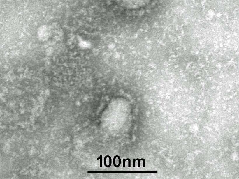 新型コロナウイルスの電子顕微鏡写真(C)朝日新聞社