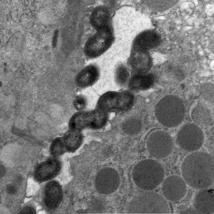 ハイルマニイの顕微鏡写真。動物実験では感染力が強いことがわかってる（中村医師提供）