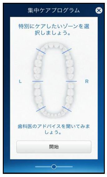 歯科医からアドバイスを受けることも