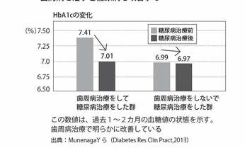 血糖値の改善に役立つ歯周病治療 糖尿病と双方向に影響するメカニズムとは?