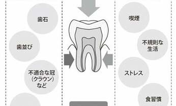 歯周病は出産にも悪影響? 歯を失うだけじゃない、歯周病の怖さとは