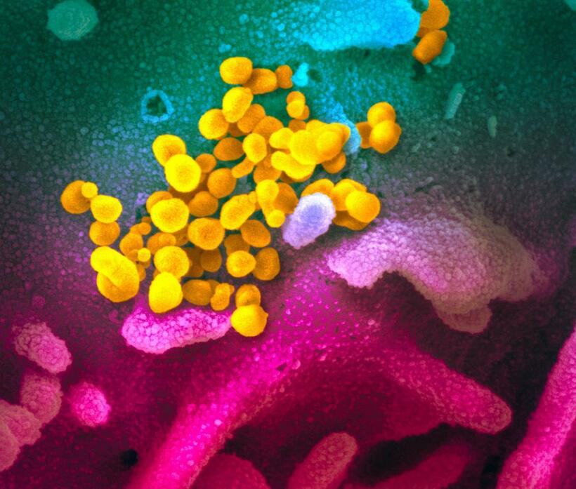 電子顕微鏡で見た新型コロナウイルス／米国立アレルギー・感染症研究所提供