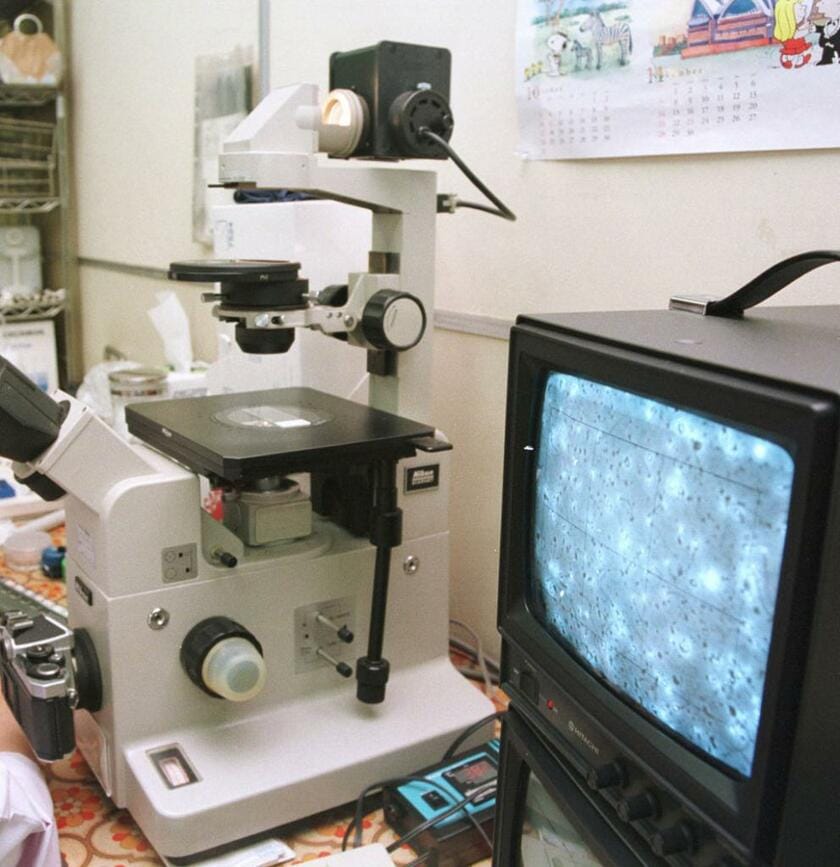 モニター画面に拡大して映し出された精子を、目視で数える検査の様子。1999年撮影　（ｃ）朝日新聞社