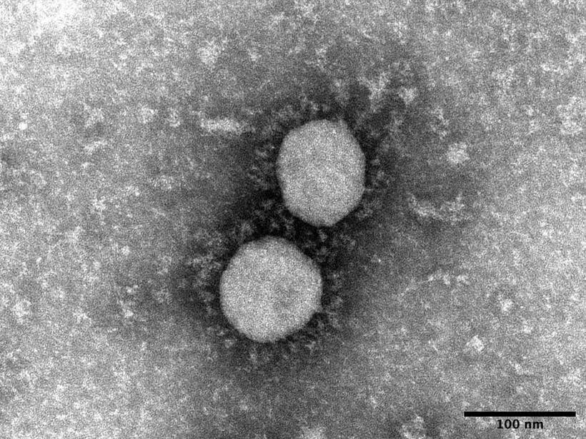 新型コロナウイルスのデルタ株＝国立感染症研究所提供