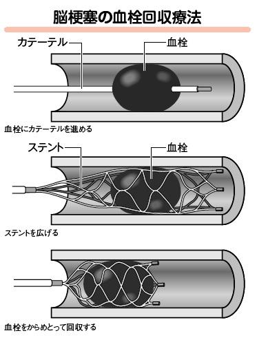 （イラスト／今崎和広）