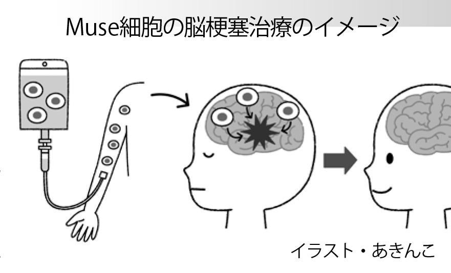 脳血管障害 (図説脳神経外科New Approach) 勇，斎藤