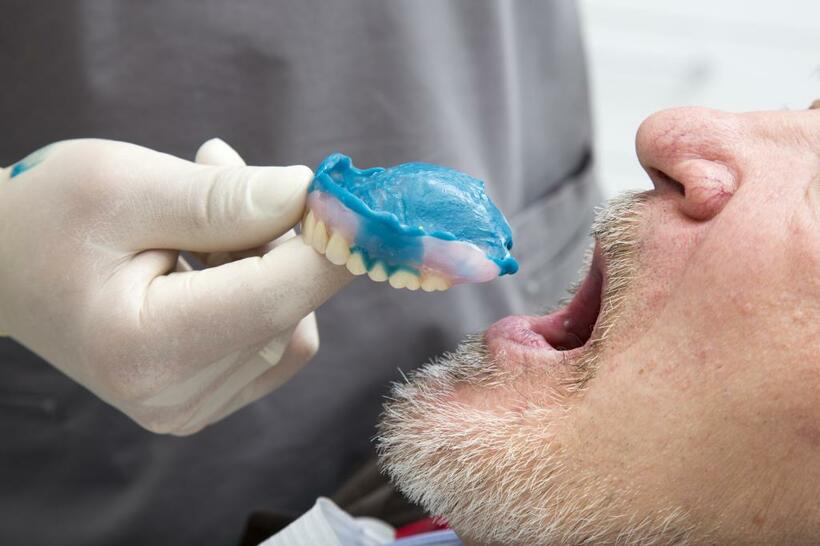 最近の入れ歯は非常に進化していて、インプラントやブリッジにはない魅力がある（写真：getty images）