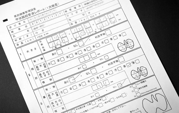 県から情報開示された男子中学生の甲状腺結果。のう胞は「あり」で、「最大の大きさ」の欄には乱雑に「３.１ｍｍ」と書かれている（撮影／写真部・植田真紗美）