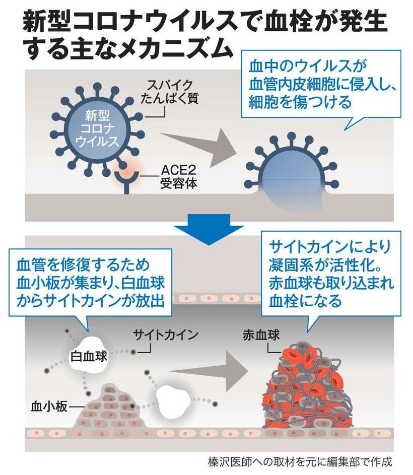 ＡＥＲＡ　２０２０年６月１５日号より