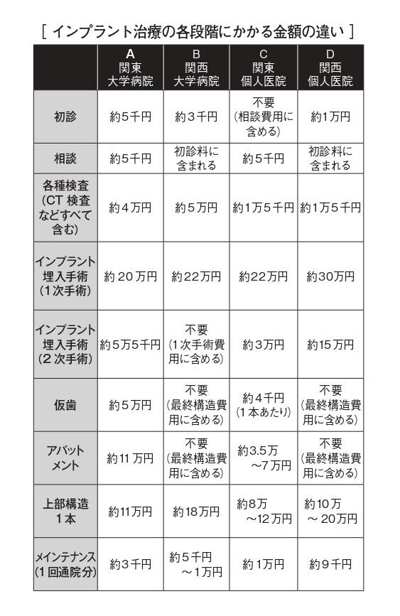 Ａ～Ｄのいずれの歯科医院も日本口腔インプラント学会の会員の施設。Ａは記事中に出てくる関東の大学病院（『「かめる幸せ」をとり戻す』より）