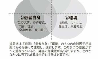 歯周病になりやすいのはこんな人! 危険度をチェックしてまずは自覚